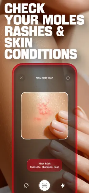 DermaScan - AI Skin Tracker screenshot 2