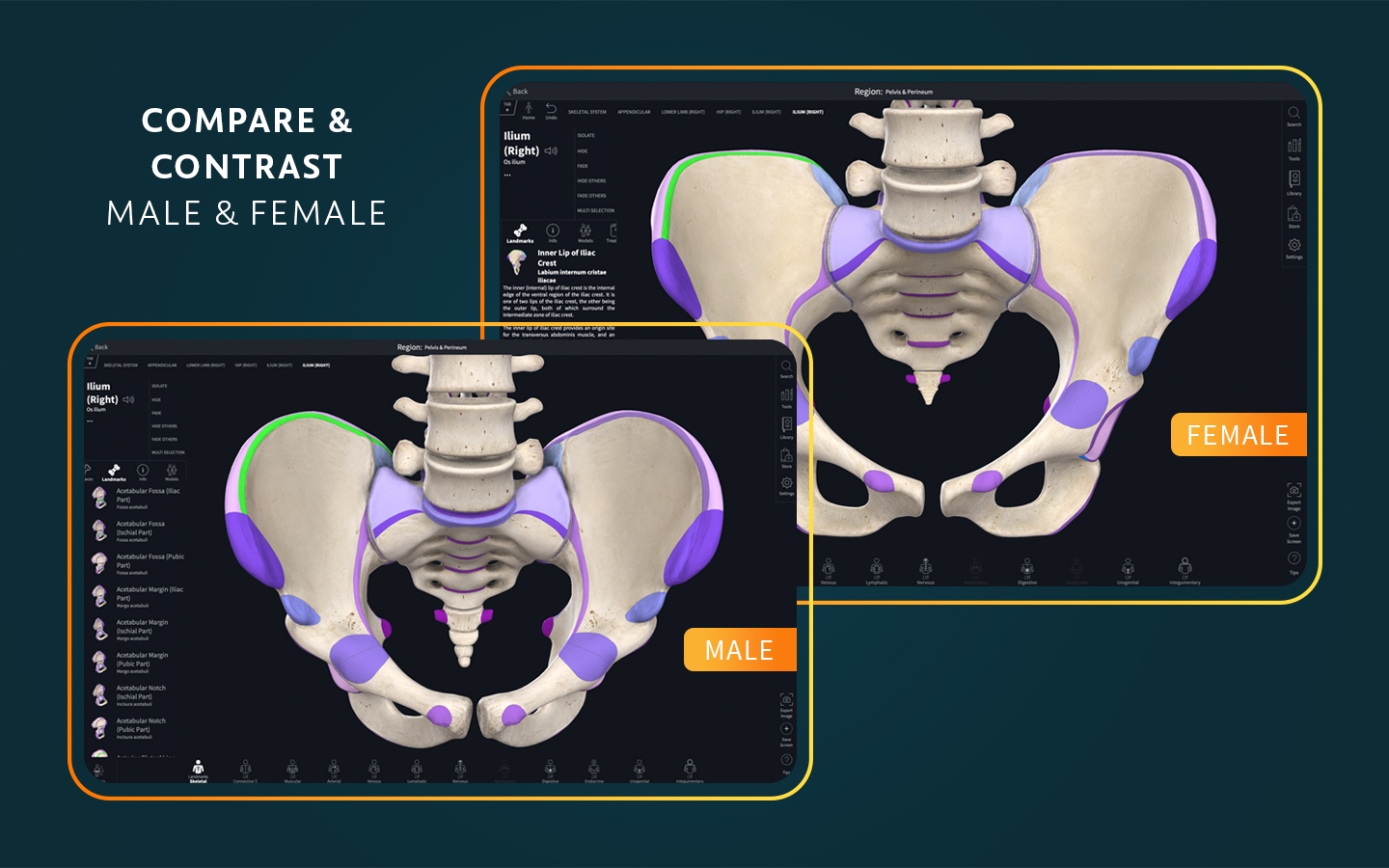 Complete Anatomy