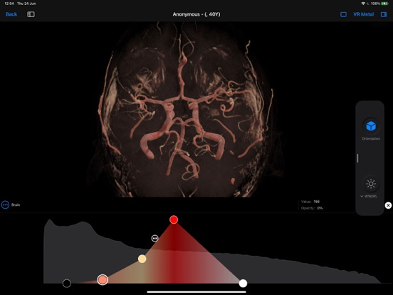 Falcon Mx iPad screenshot 4 - Medical app