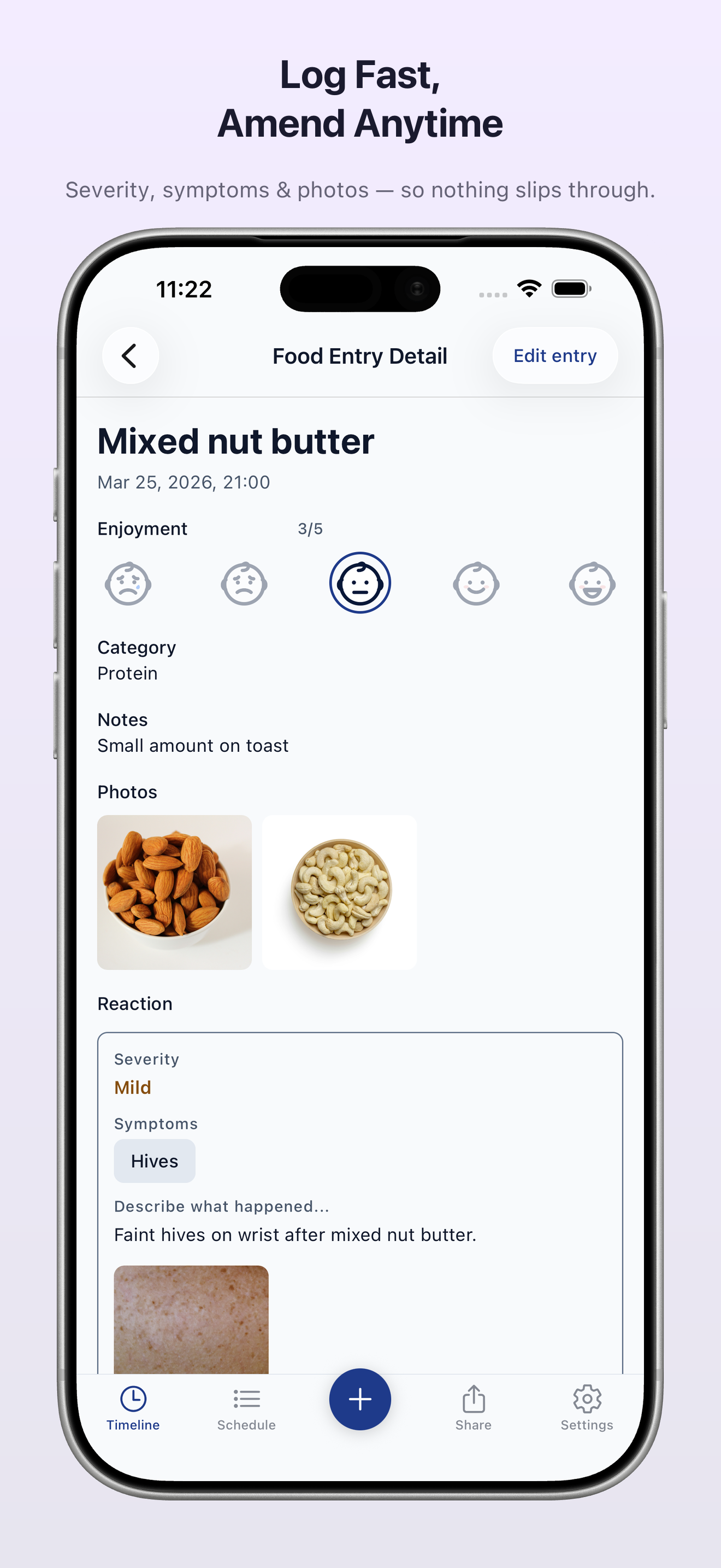Baby Food Tracker & Allergies