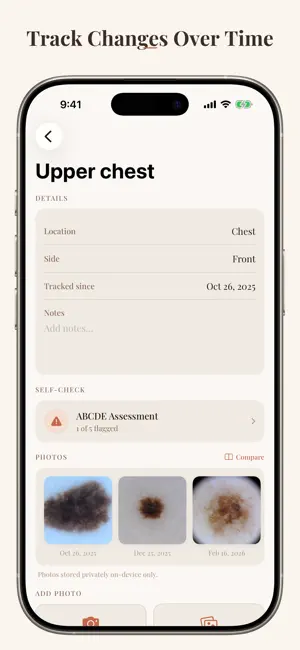 Skin Map: Mole Tracker & Check screenshot 2