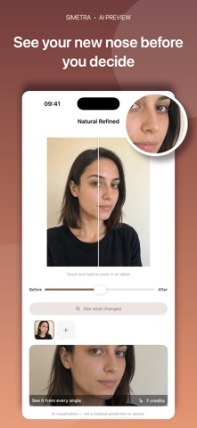 Nose Job Simulator: Simetra Screenshot 1 of 7