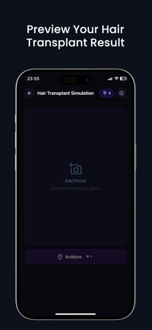HairMorph: Hair Transplant AI iPhone screenshot