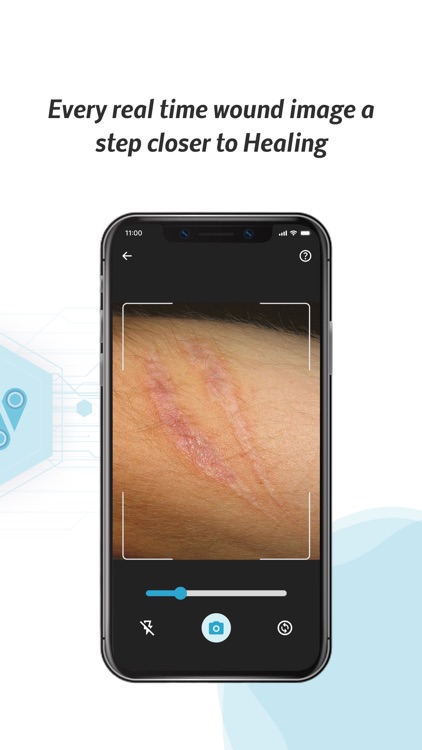 WoundTele: AI Wound Care