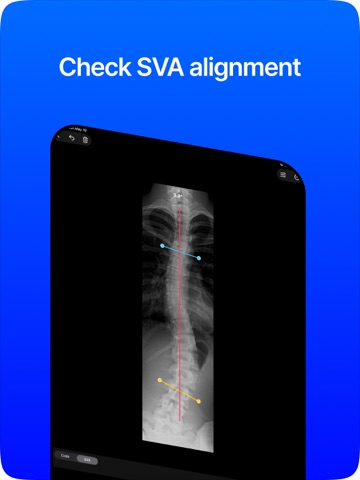 Cobb Angle Pro Spine X-Ray iPad screenshot
