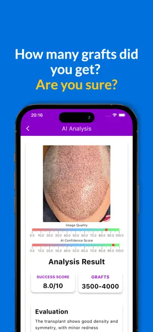 Graft Count - Hair Transplant screenshot 1
