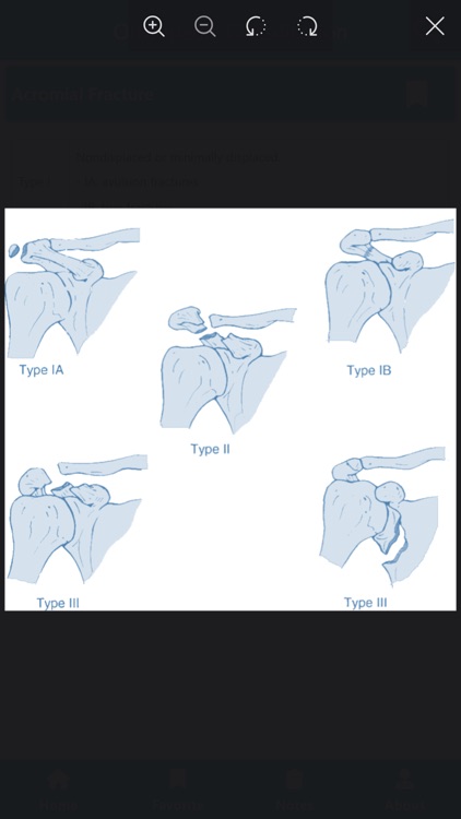 Fractures Classification App screenshot-4