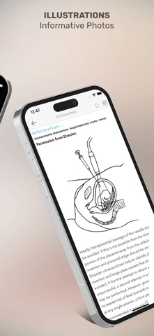 High Risk Pregnancy Mgmt iPhone screenshot