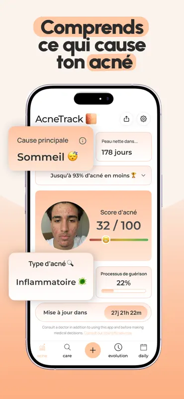 AcneTrack – Plan anti-acné screenshot 3 of 10