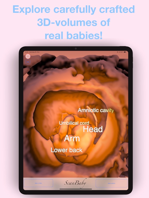 ScanBaby learn baby ultrasound iPad screenshot 5 - Medical app