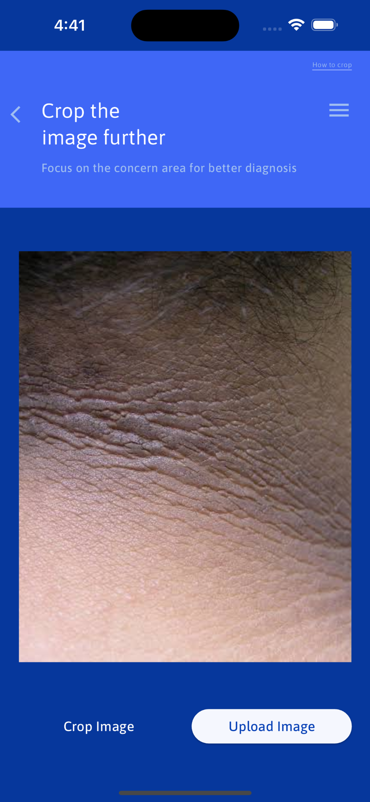 DermaLens by AiM4u