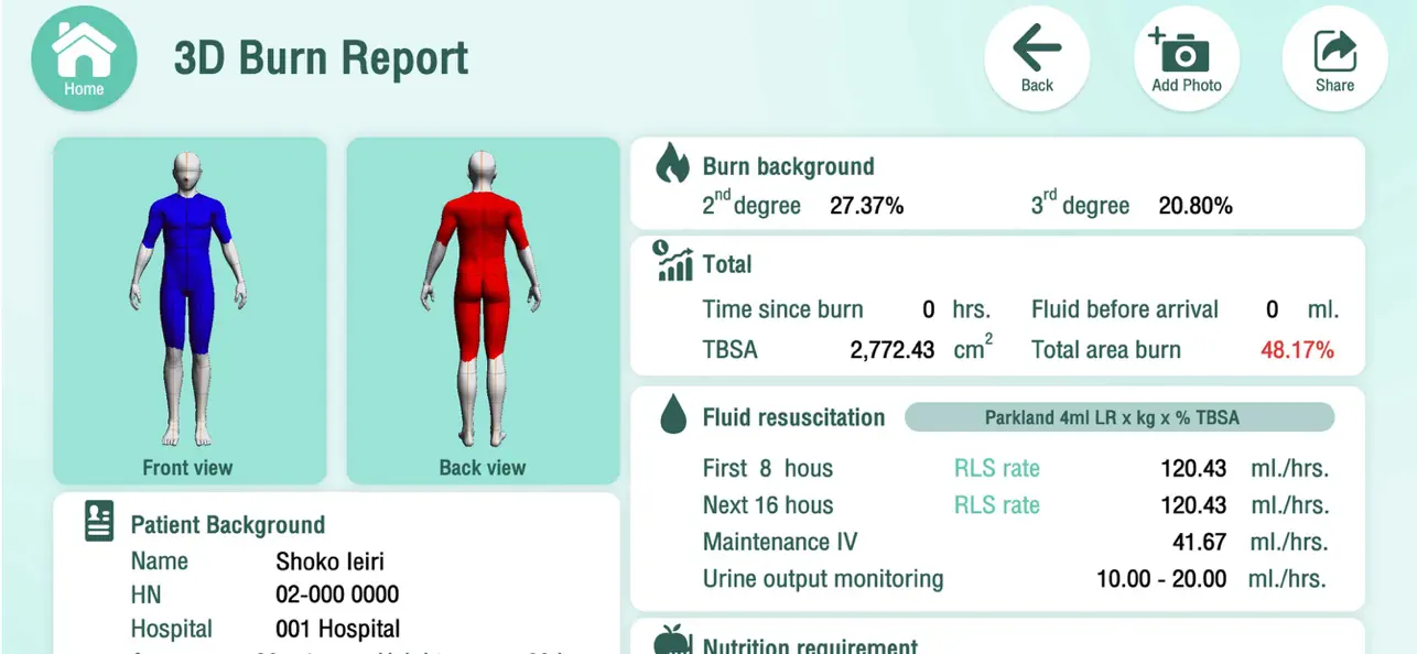 Screenshot #3 pour 3D Burn