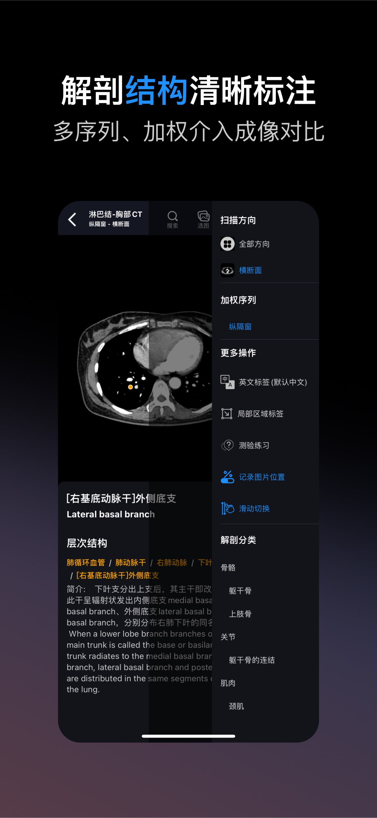 影像解剖图谱 截图 5
