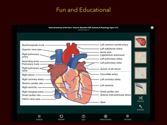 Screenshot #4 pour Anatomy Puzzles