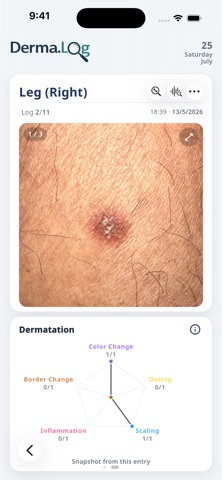 Derma.Log screenshot