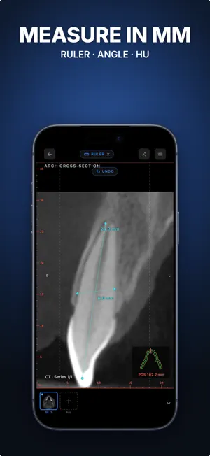 Ossidex: DICOM Viewer CT & MRI screenshot 4