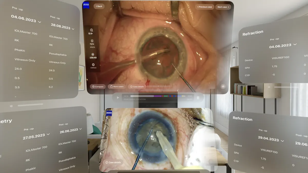 ZEISS Surgery Optimizer screenshot 4