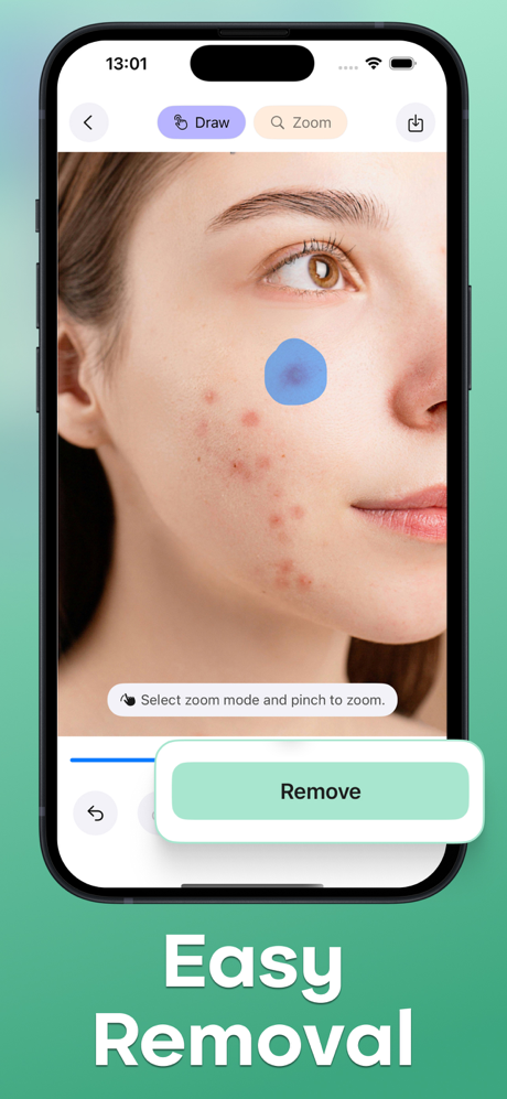 Acne Remover - Pimple Eraser screenshot 2