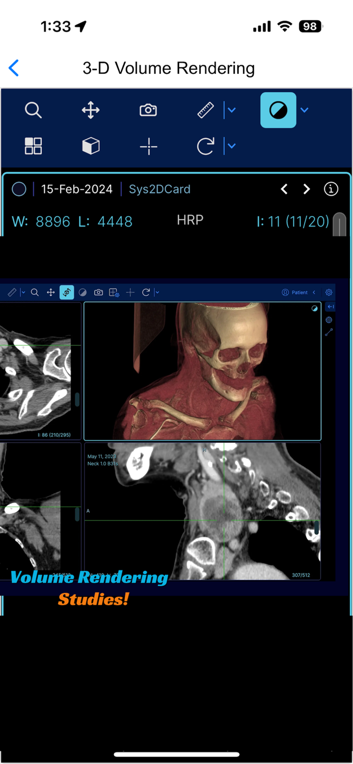 EazyGo  Easy PACS  DICOM