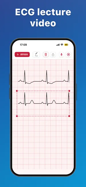 ECGStudio: ECG Draw & Lecture screenshot 2