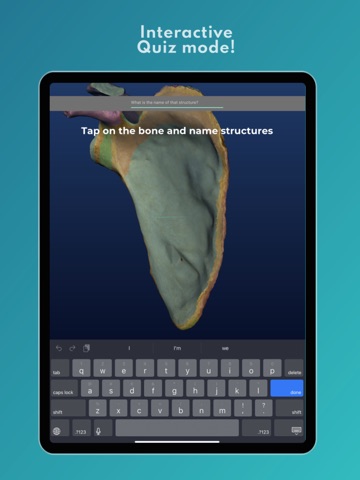 Skelviewer2 iPad screenshot