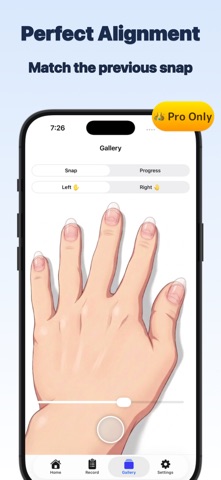 StopBite: Nail Biting Tracker Screenshot 4 of 9