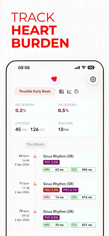 ECG+ | Your Watch ECG Reader screenshot 6 of 9