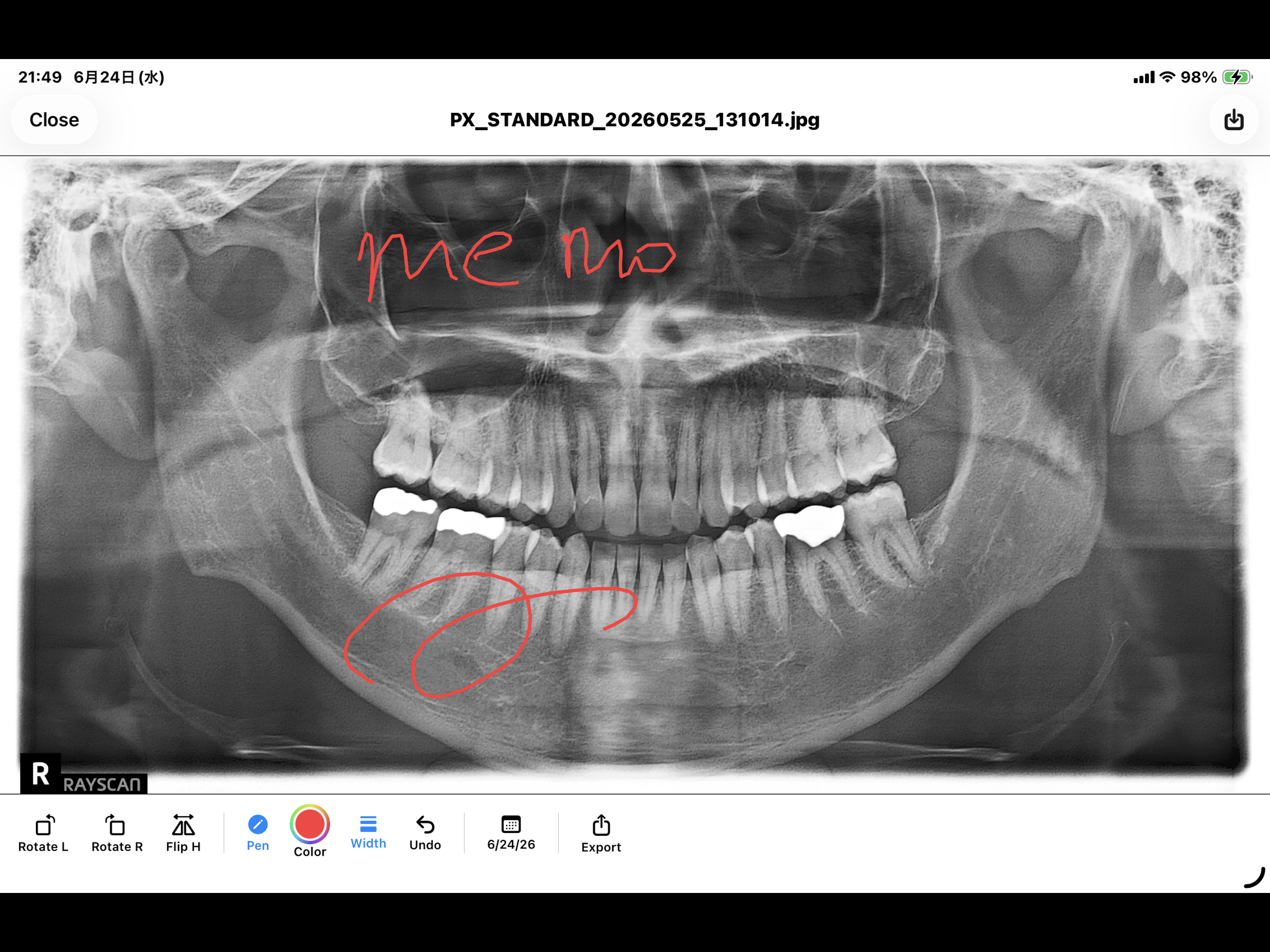 DentalCT screenshot 8
