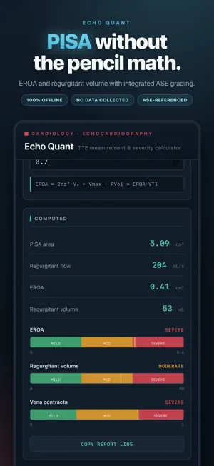 Echo Quant: TTE Calculator screenshot 4
