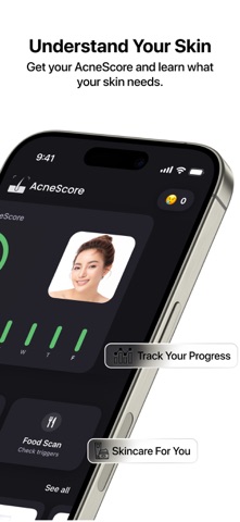 AcneScore | Identify Triggers Screenshot 3 of 10
