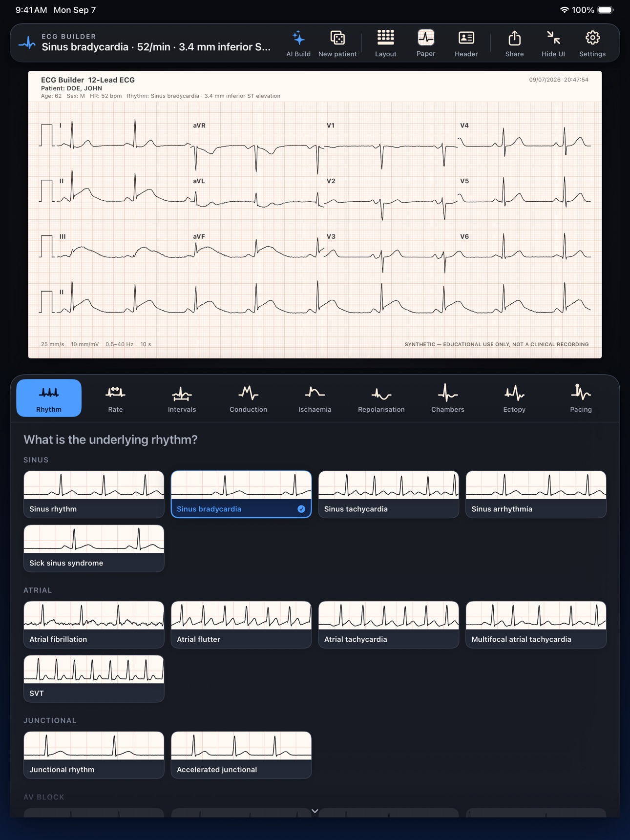 Screenshot 7 of ECG Builder
