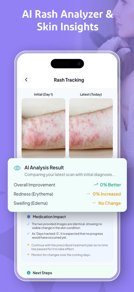 Rash Scan: AI Dermatologist - Medical App | MWM