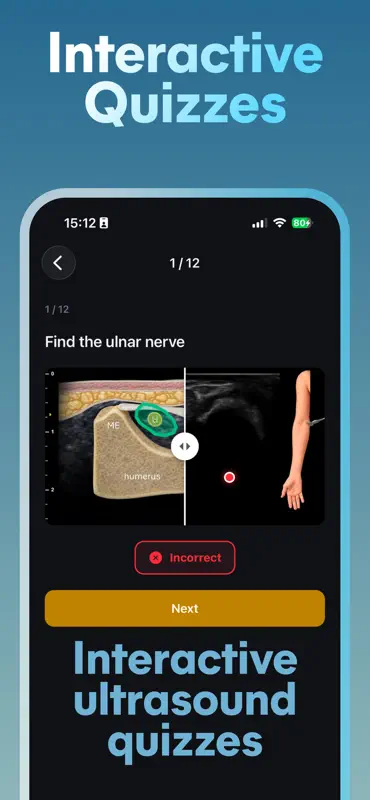 MSK Sono: Ultrasound Guide screenshot 5 of 6