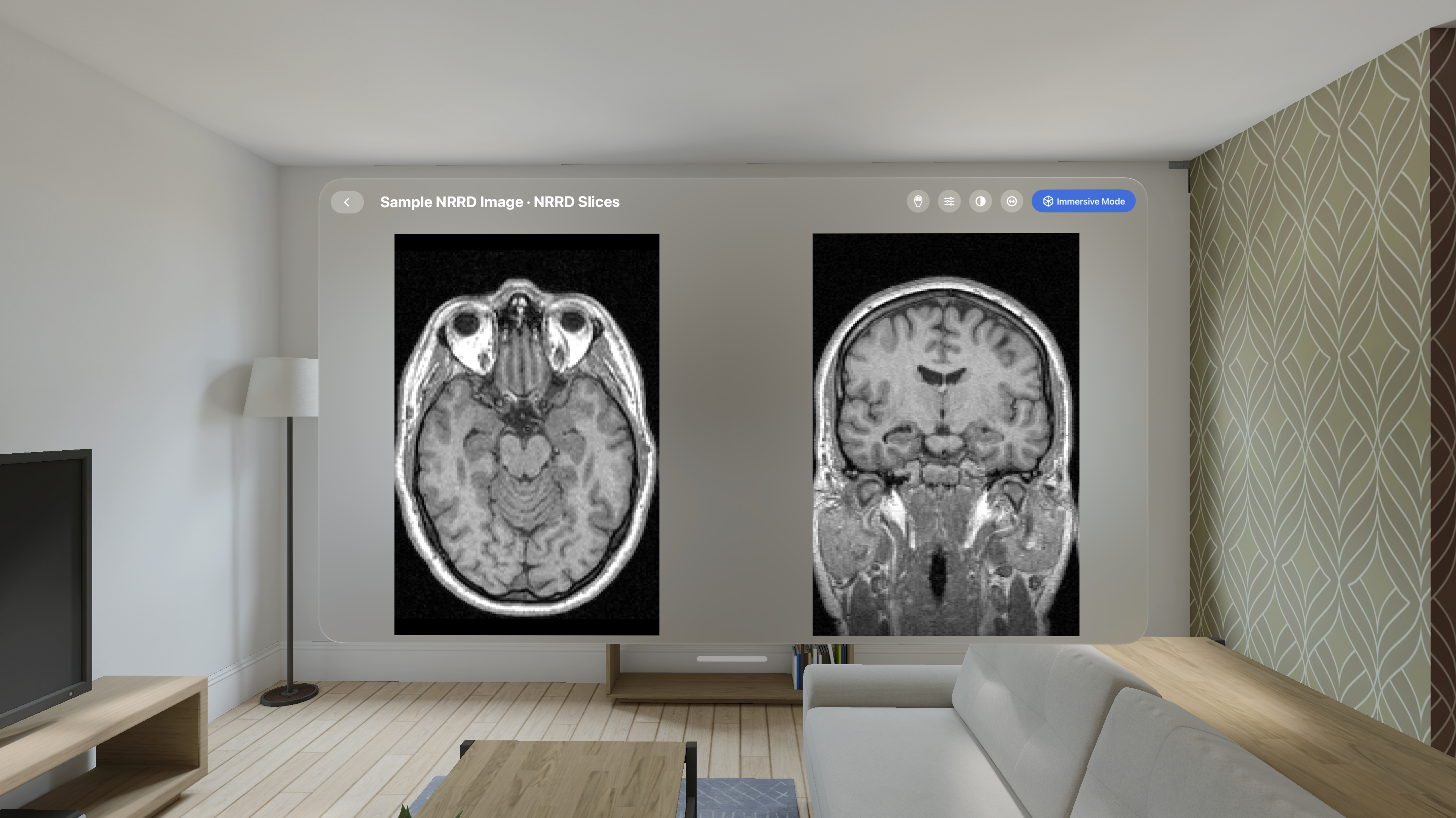 VoxelVision AR Medical Imaging screenshot 21