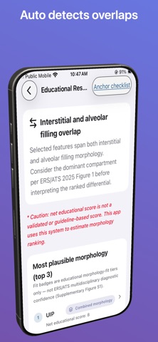 ILD Patterns Screenshot 5 of 10