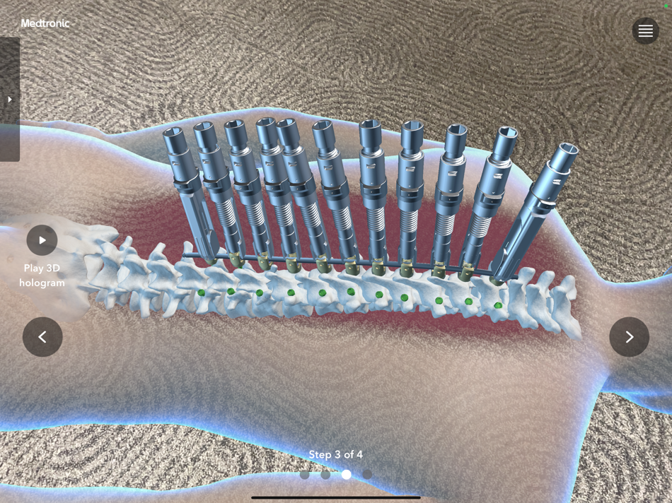 #3. ModuLeX XR (iOS) 由: Medtronic, Inc.