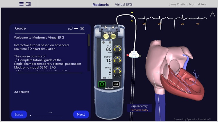 Medtronic VirtualEPG
