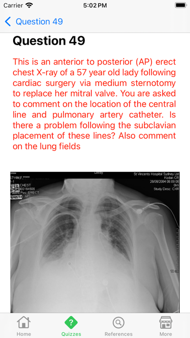 Screenshot #2 pour X-Ray Interpretation Guide
