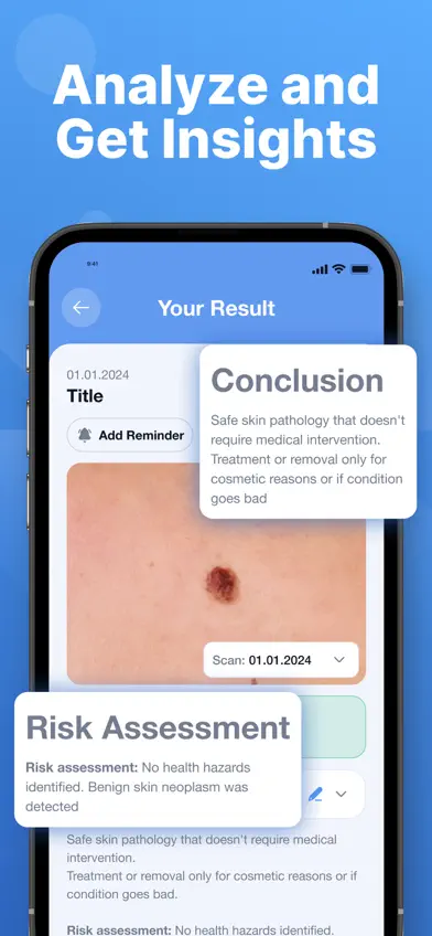 AI Skin Scanner: Mole Tracker screenshot 2