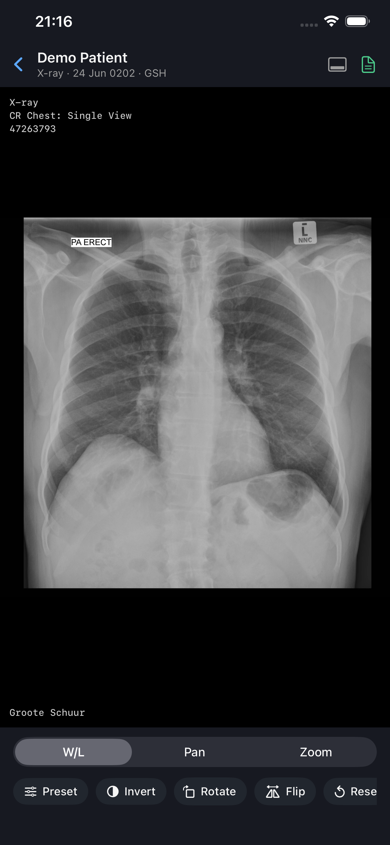 PACS screenshot 4