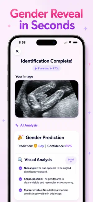 Baby Gender Scanner: Nub Test screenshot 3