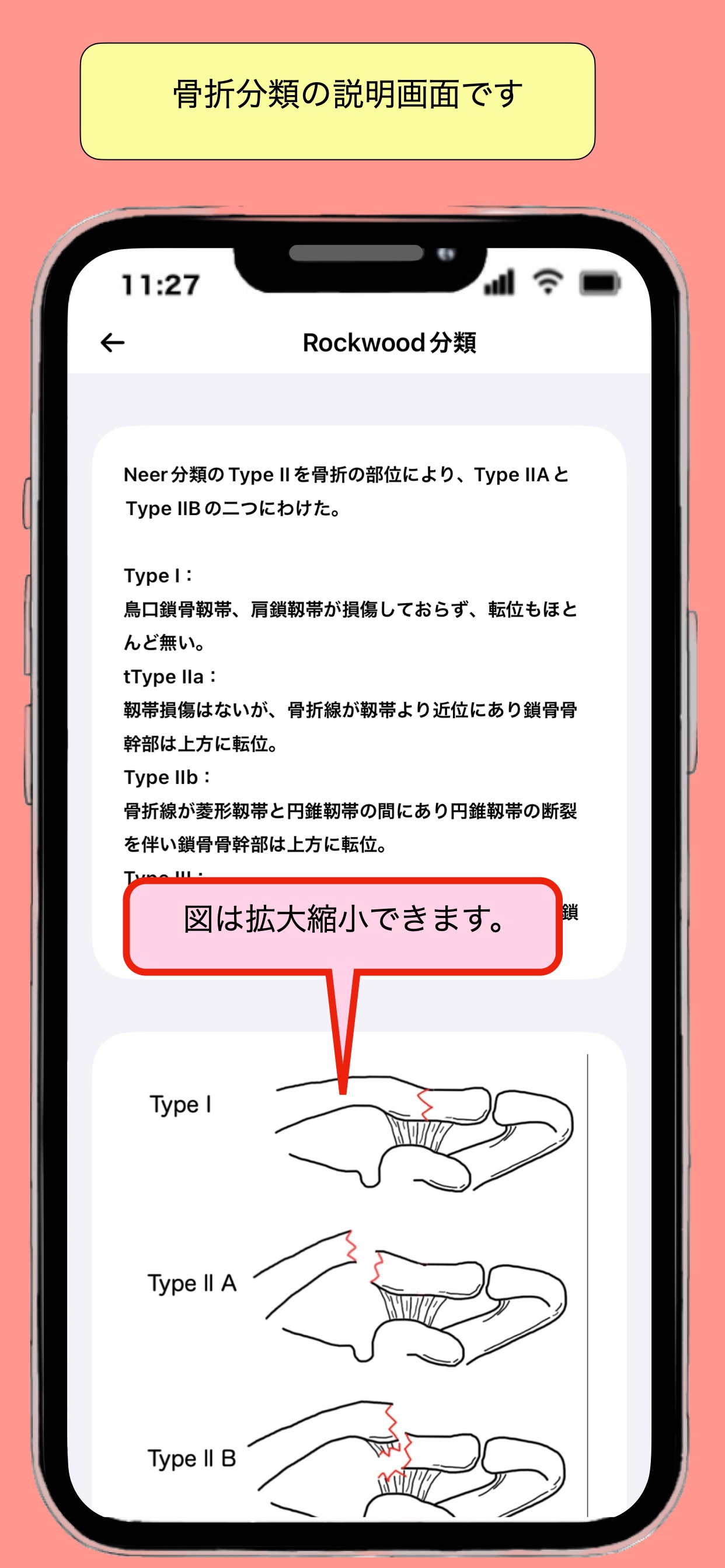 Screenshot 6 of 整形外科治療ガイド_骨折から理学所見まで