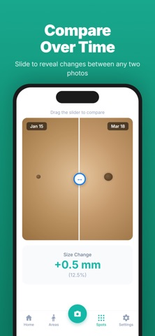 SkinTrack – Spot the Change screenshot