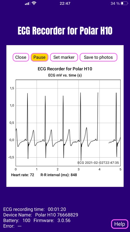 ECG Recorder for Polar H10 screenshot-4