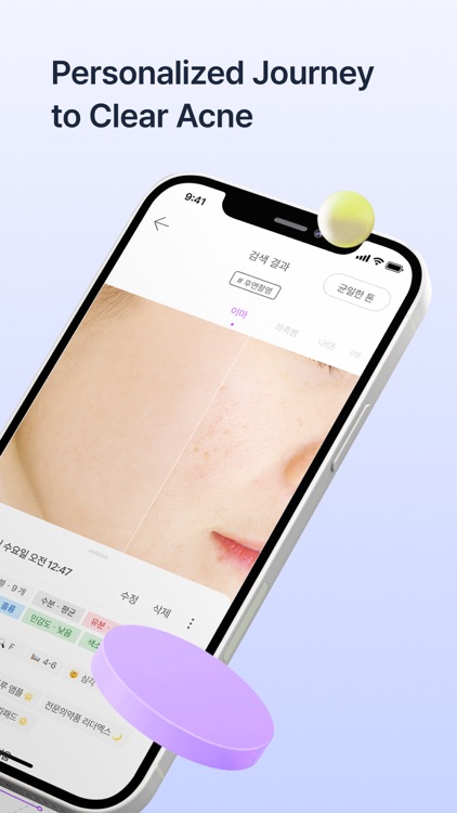 Skinlog | Acne diary