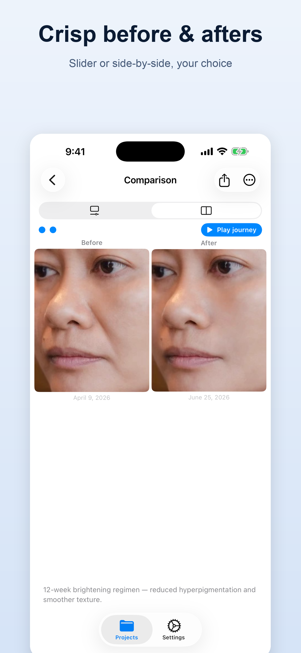 SideLens Before & After Photos screenshot 3