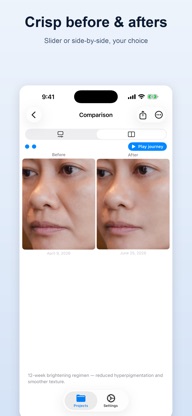 SideLens Before & After Photos screenshot 3
