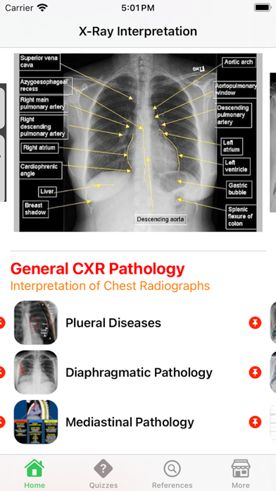 X-Ray Interpretation Guide Screenshot