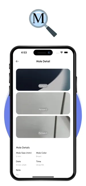 Melanoscope screenshot 4