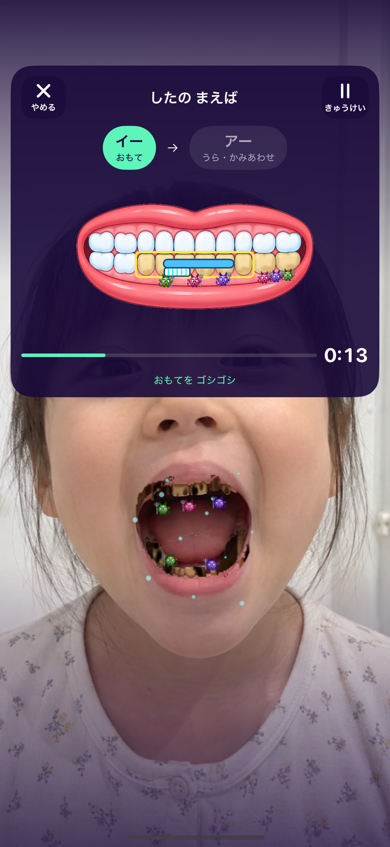 Screenshot 3 of むしばミラー